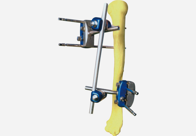  Ⅳ型2号 肱骨支架