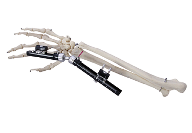 骨科外固定支架术后护理要点与并发症预防