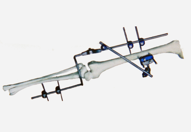 Ⅳ型2号 膝关节固定